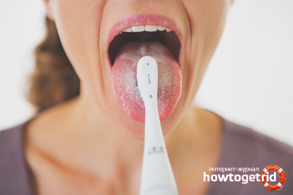 Как да почистите езика от плака