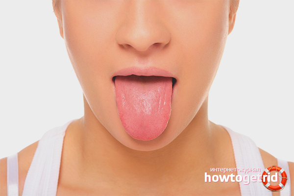 Определение на заболяването чрез плака на езика