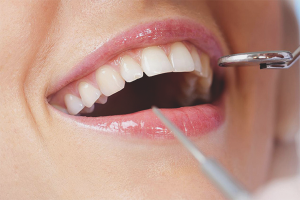 Hvordan bli kvitt periodontal sykdom