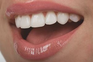 Как да укрепим зъбите, ако те се разрушат