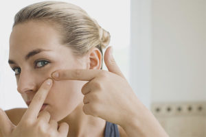 È possibile spremere l'acne sul viso